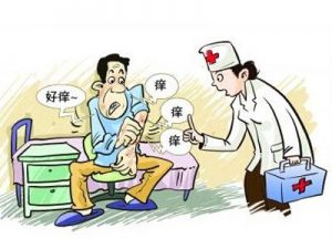 银屑病怎么治疗？