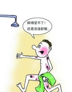 红皮病型银屑病的临床表现